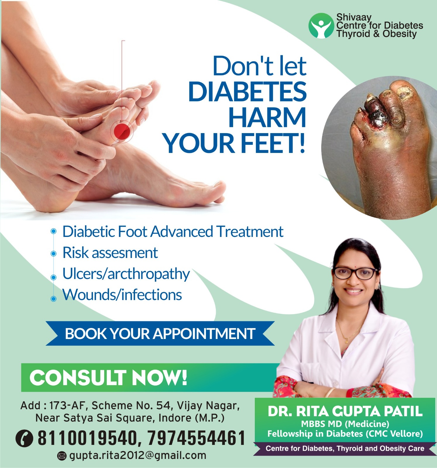 Best Diabetologist For Foot Diabetes Treatment in Indore